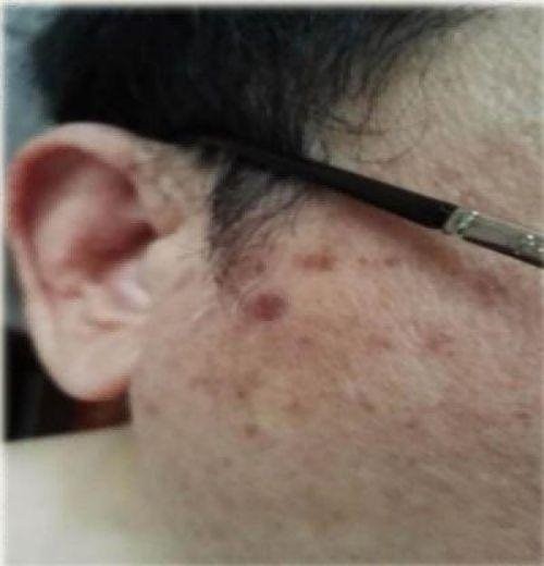 聚焦全国2026两会报道 现代科技量氢氧元素绿色自然疗法！(廖永贵院士)