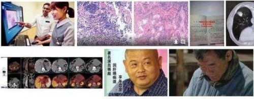 冉明医师创新国医精粹 铺就患者“健康之路”