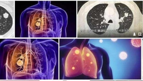 冉明医师创新国医精粹 铺就患者“健康之路”