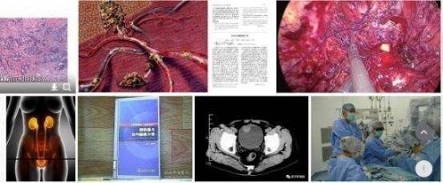 冉明医师创新国医精粹 铺就患者“健康之路”