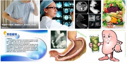 冉明医师创新国医精粹 铺就患者“健康之路”