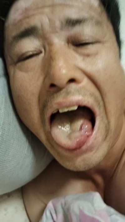 医路五十八载 匠心消融千疾 —— 医学领航者宁永球的传奇人生与医学革新之路