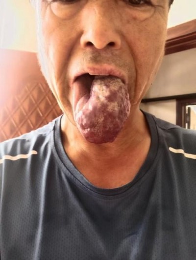 医路五十八载 匠心消融千疾 —— 医学领航者宁永球的传奇人生与医学革新之路